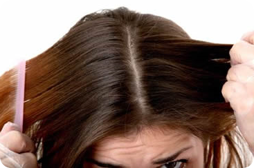 Causes of Dandruff